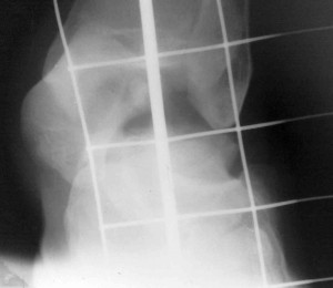 Рентгенограмма голеностопного сустава.