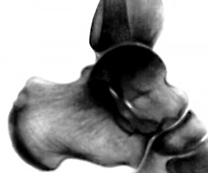 Таранная кость на рентгенограмме.